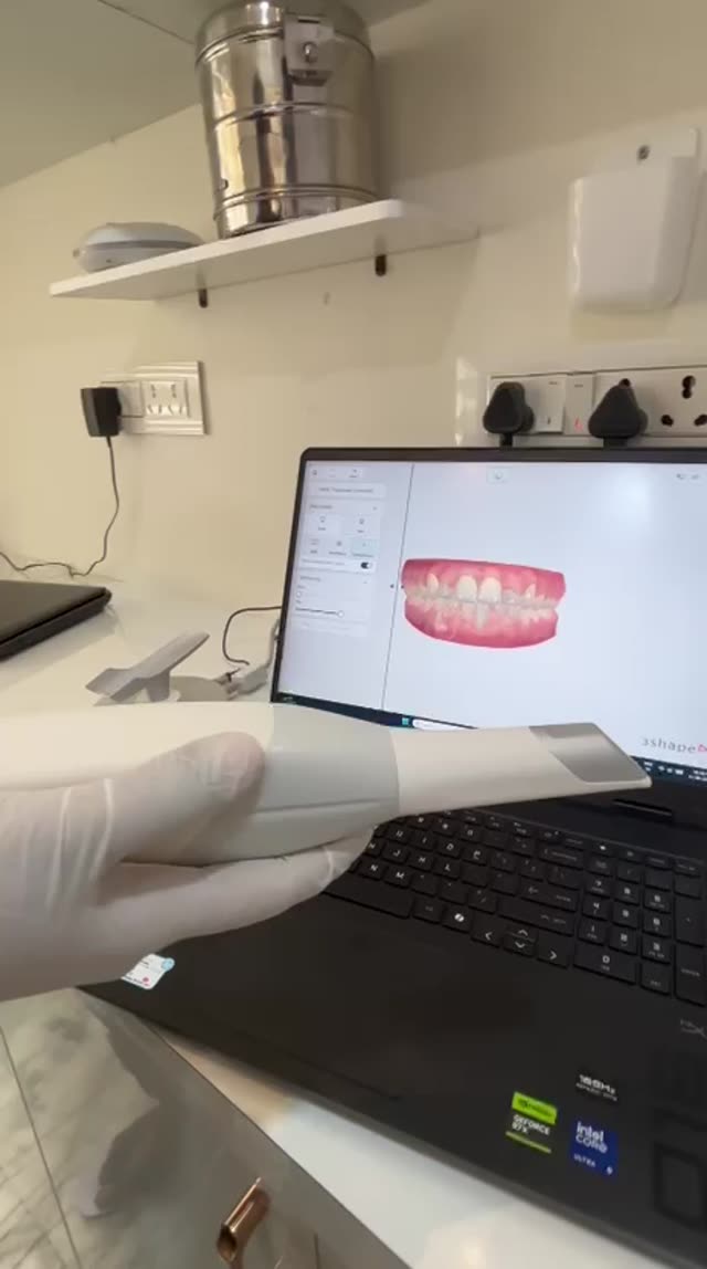 Digital Intraoral Scanning